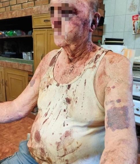 Eldorado: Violento robo a mano armada,un hombre de 81 años fue golpeado y despojado de sus bienes